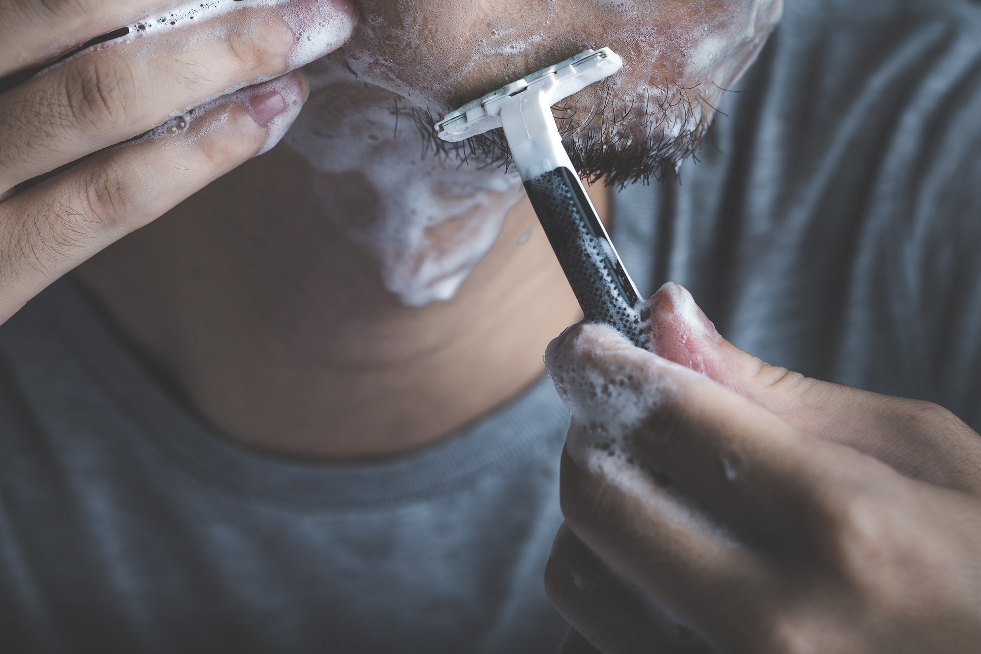 髭剃り負けで痛い想いをしたくない… 原因と対策は？